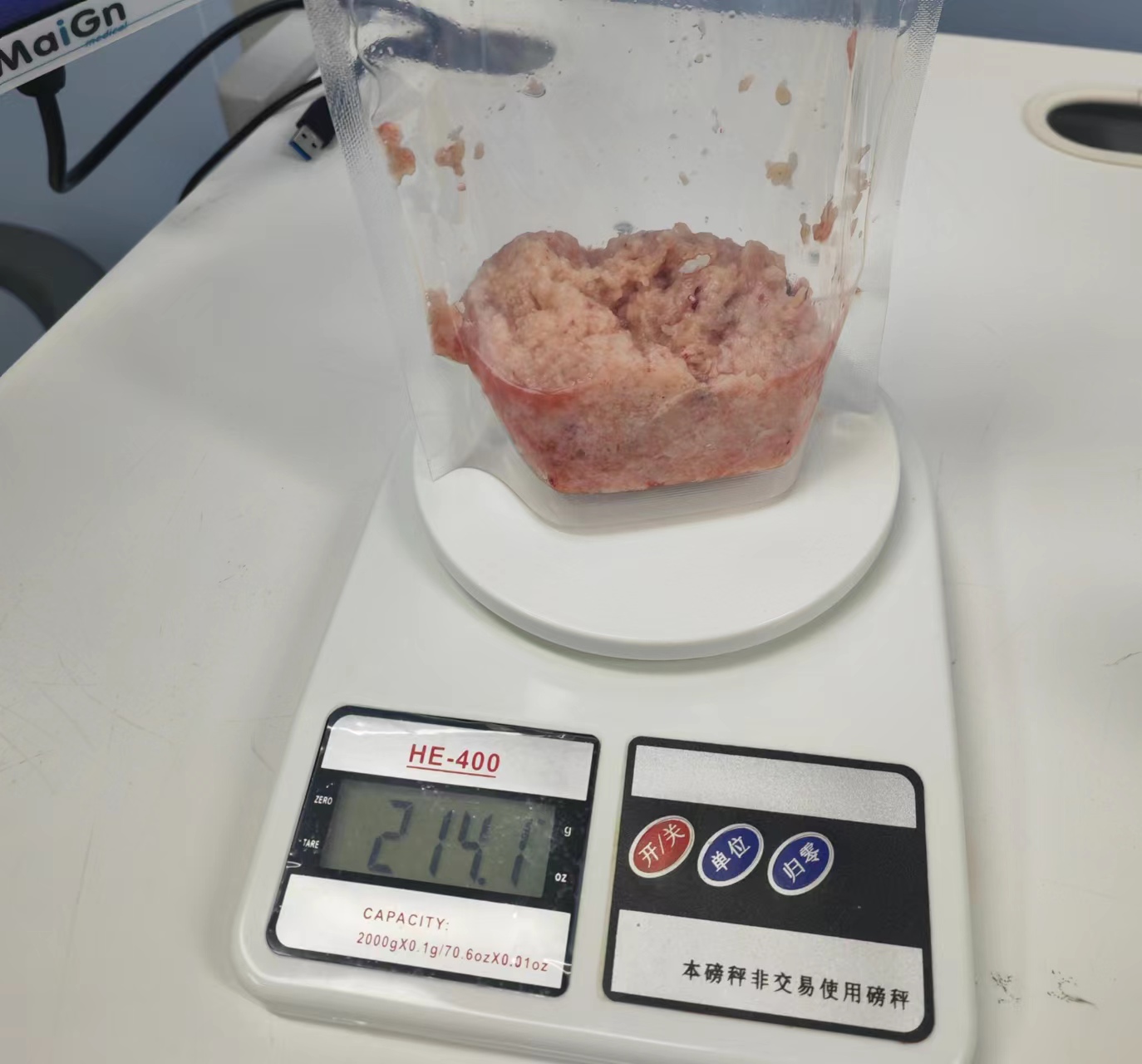泌尿外科一病區巨大前列腺剜除
