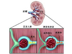 臨床表現(xiàn)