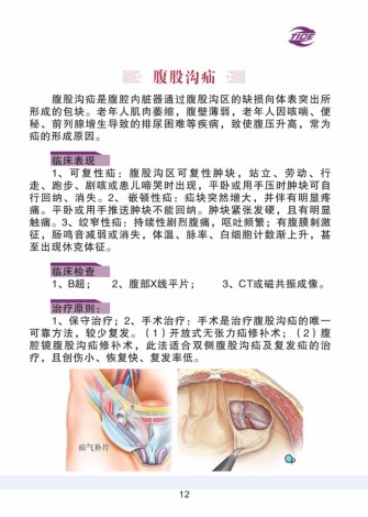 普外科加速康復外科手冊_12.jpg