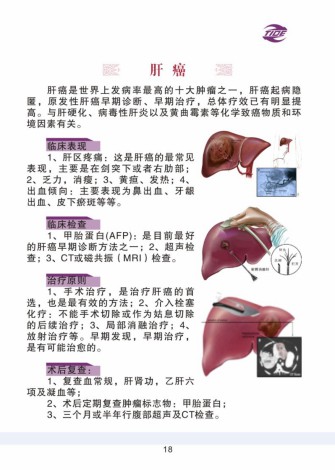 普外科加速康復外科手冊_18.jpg