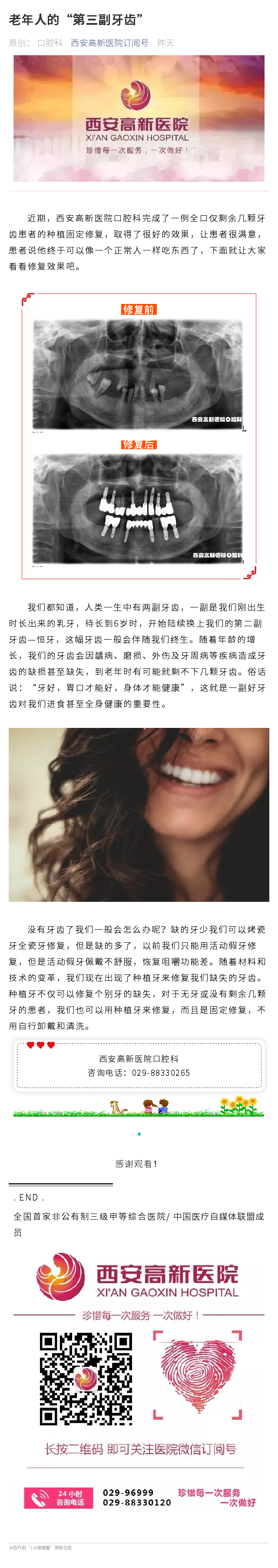 老年人的“第三副牙齒”.png