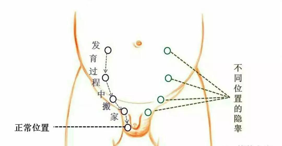 過程.jpg